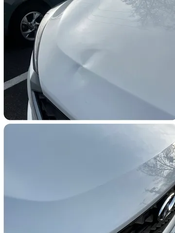 Dent repair